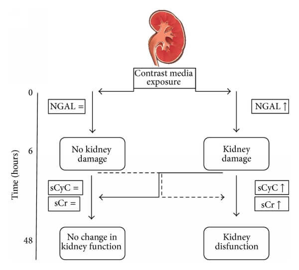 CysC與NGAL、Cr的關(guān)系