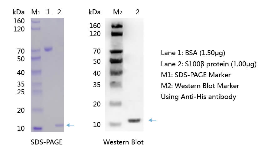 歐凱生物S100B蛋白的SDS-PAGE和WB分析圖