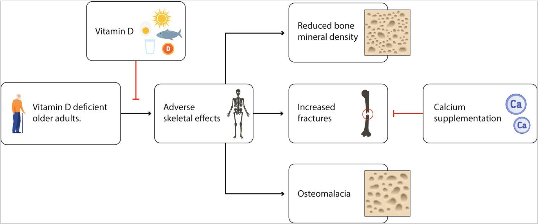 老年人維生素D缺乏對(duì)骨骼的影響以及維生素D在預(yù)防中的作用